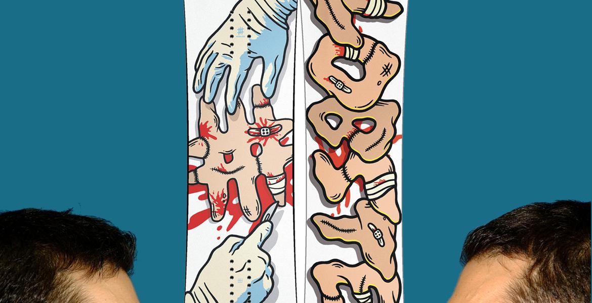 極美品！LOBSTER　nosejob Method Mag Lobster Nose Job 2014